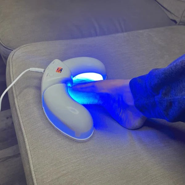 Nagel Laser Schimmel Apparaat