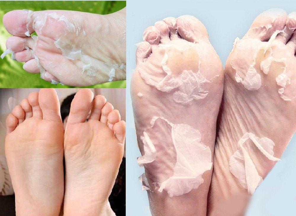 Babies Feet Originele Diepe Hydraterende Exfoliatie voor Voeten Peel Sokken (1 Paar Set)