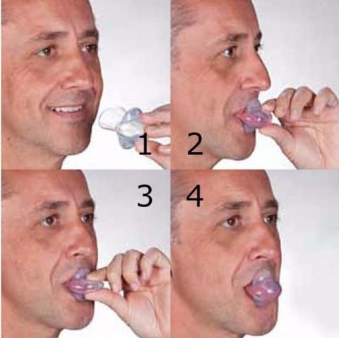 Apnea Tongue Stabiliserend Apparaat