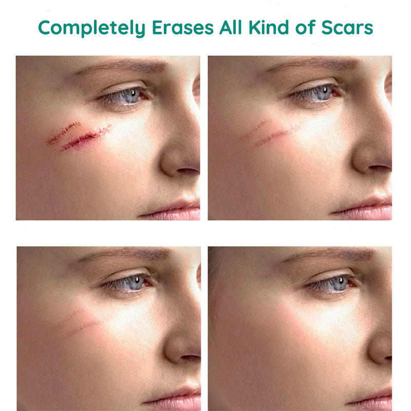 Scar Repair Hudtoner