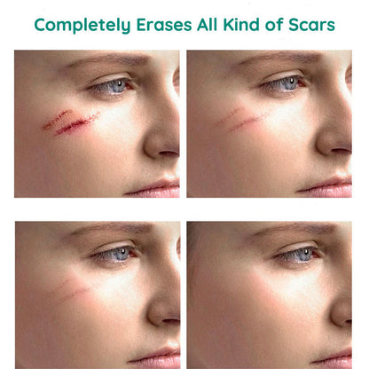 Scar Repair Hudtoner