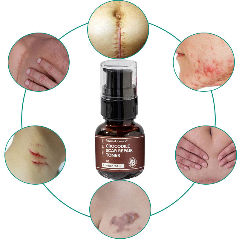 Scar Repair Hudtoner