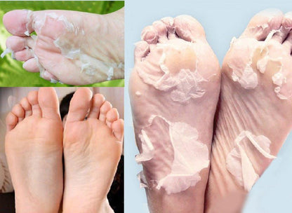 Babies Feet Originele Diepe Hydraterende Exfoliatie voor Voeten Peel Sokken (1 Paar Set)